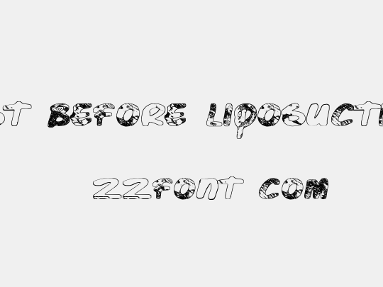 Just Before Liposuction